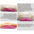 Moimedic Lumbar Wedge Pillow
